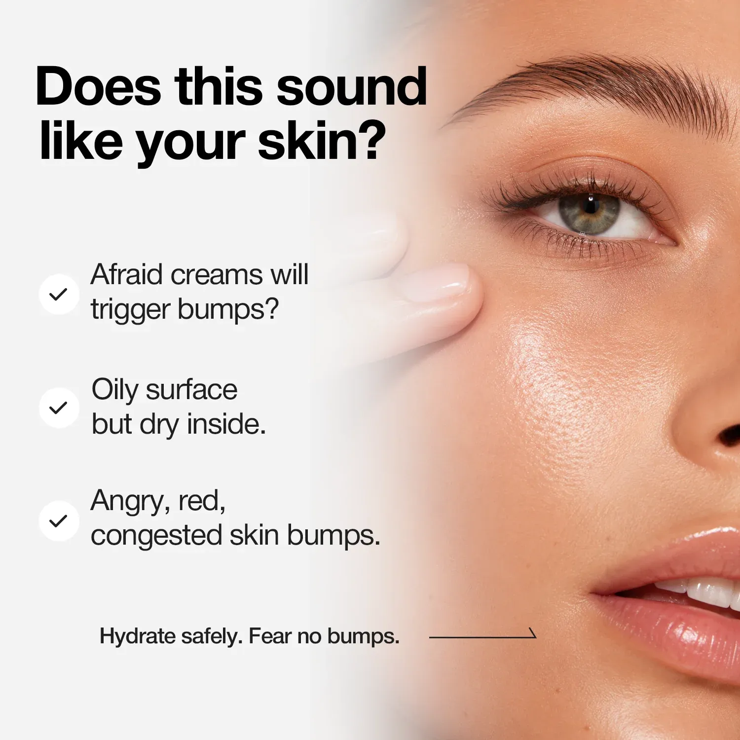 NINELESS A-Control Azelaic Acid Cream 50ml
